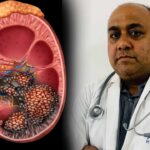 Kidney Cancer Awareness
