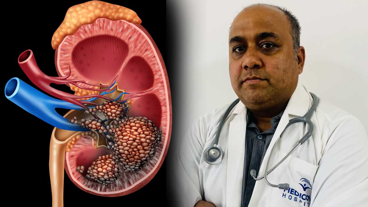 Kidney Cancer Awareness