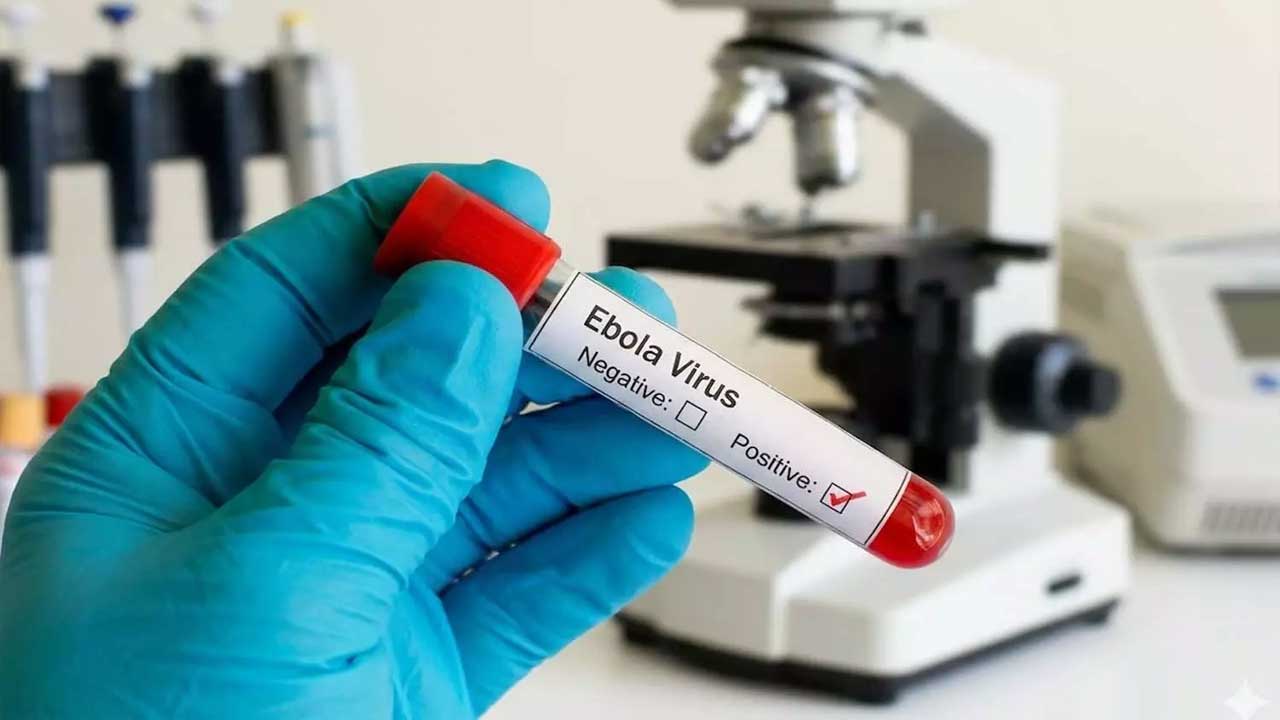 Ebola Alert Hyderabad | శంషాబాద్లో ఎబోలా లక్షణాలతో వ్యక్తి గుర్తింపు.. గాంధీకి తరలింపు 2 ebola.1 1
