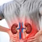 Stage 2 Kidney Disease