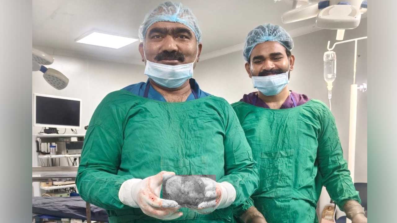 Bladder Stone Surgery |