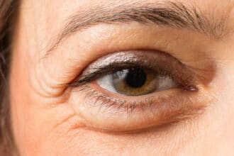 Morning Eye Swelling