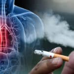 Smoking Cessation Benefits