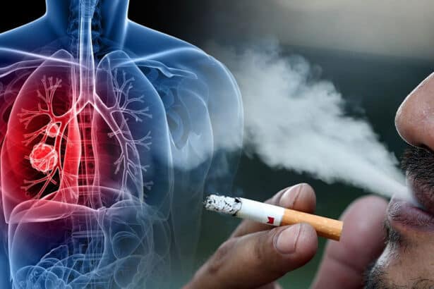Smoking Cessation Benefits