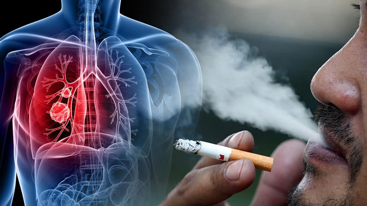 Smoking Cessation Benefits